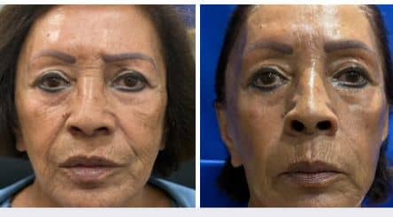 Slider image (3) Aesthetic and Oncologic Face, Head and Neck Clinic and OR